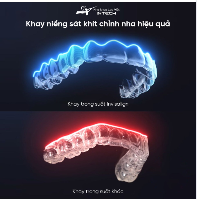 INVISALIGN - THIẾT KẾ ĐỘC QUYỀN CHO NỤ CƯỜI CỦA BẠN 