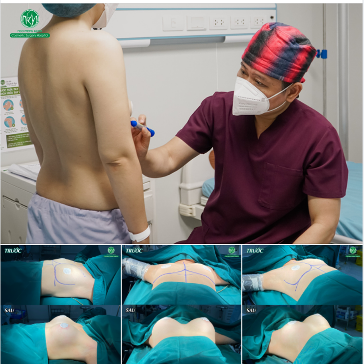 KẾT QUẢ CA NGỰC NỘI SOI CHIỀU NAY