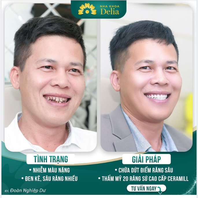 KH Đoàn Nghiệp Dư "Trẻ ra cả 10 tuổi, làm răng sứ vừa an toàn vừa thẩm mỹ"