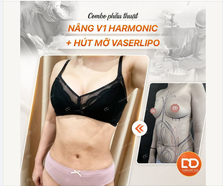 Khách hàng của DrD kiểu ĐÃ KHÔNG LÀM THÌ THÔI, CÒN LÀM LÀ PHẢI LÀM LUÔN COMBO