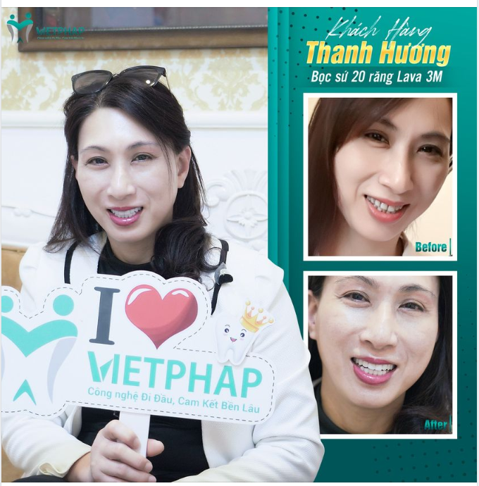 KHÁCH HÀNG THANH HƯƠNG BỌC SỨ TẠI VIỆT PHÁP