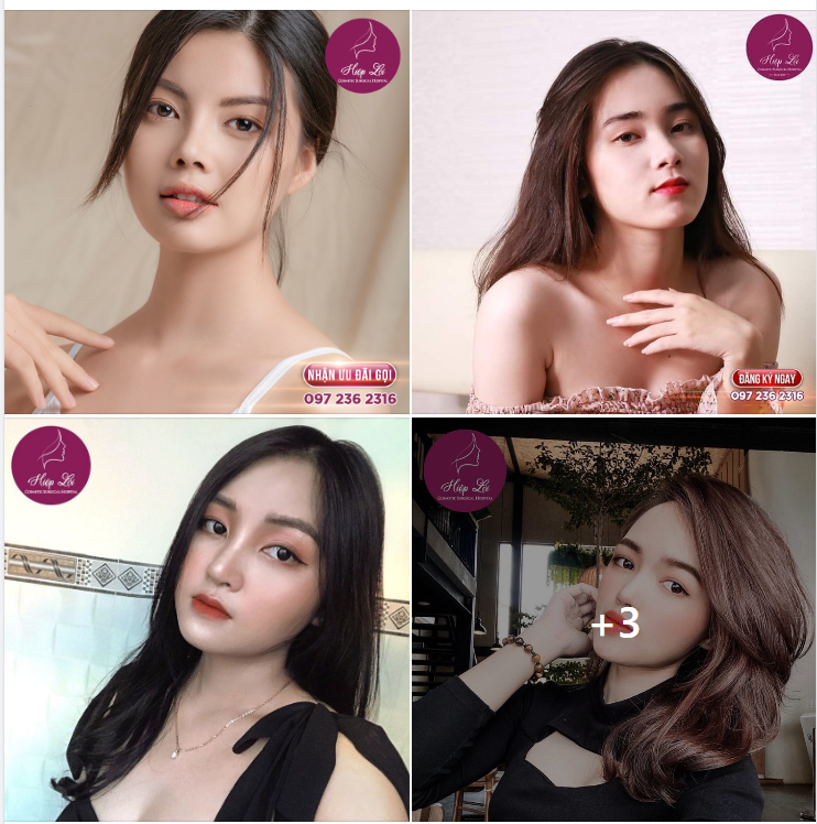 Khách hàng tiếc nuối Vì không đi làm Mũi sớm hơn