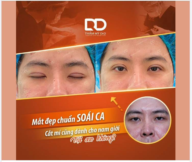 KHI CẮT MÍ KHÔNG CÒN DÀNH RIÊNG CHO PHÁI ĐẸP