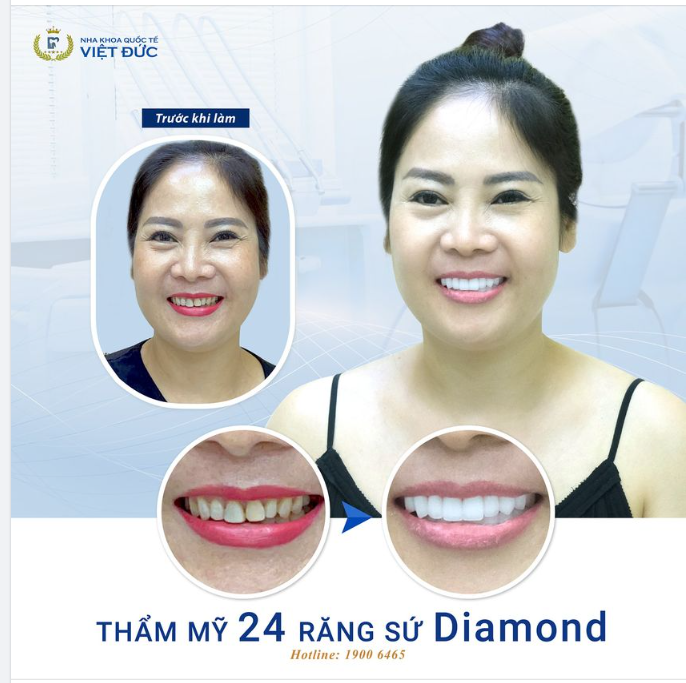 KHOẢNH KHẮC ĐẸP NHẤT CHÍNH LÀ KHI CÔ ẤY MỈM CƯỜI