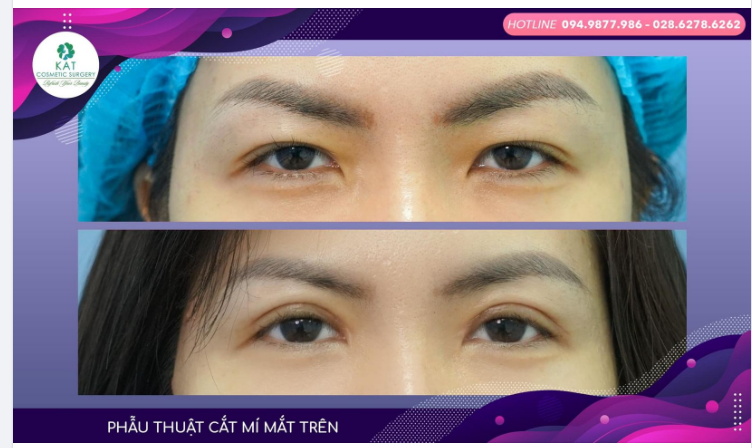 Khởi động tuần mới với đôi mắt cười