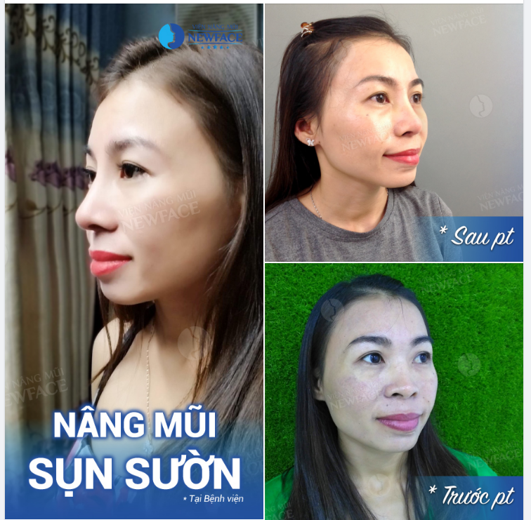 Không chọn người có tất cả. Chỉ chọn người dành tất cả cho mình...!