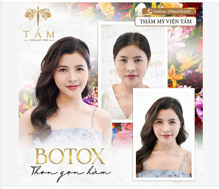 KHÔNG CÒN NỖI SỢ PHẪU THUẬT ”GỌT HÀM” VÌ ĐÃ CÓ BOTOX THON GỌN HÀM TẠI TẤM