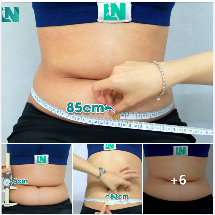 KHÔNG ĐỂ LẠI SẸO, KHÔNG CAN THIỆP CĂNG DA. 