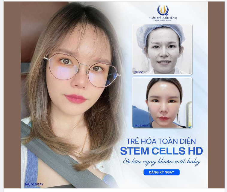 Khuôn Mặt hốc hác, góc cạnh, da chùng nhão. Già trước tuổi, thiếu sức sống,...