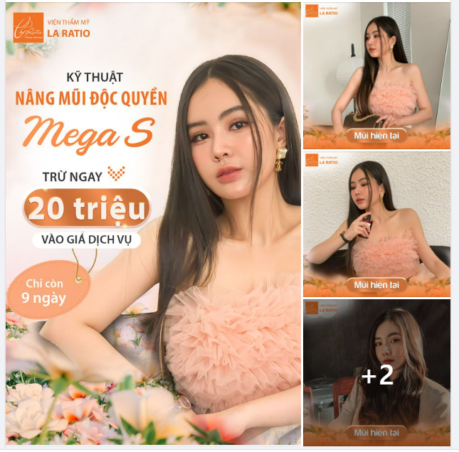 Kỹ thuật Nâng mũi Độc quyền MegaS