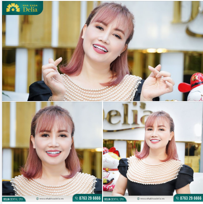 Là phụ nữ, lại còn là một người nghệ sĩ, nụ cười đẹp với những chiếc răng xinh là điều nhanh nhất để tạo được thiện cảm với người đối diện, nhưng với Hoàng Yến sức khỏe của răng miệng mới là điều quan trọng nhất.