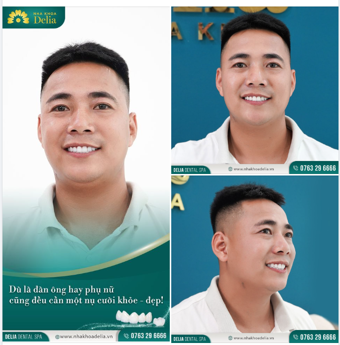 Làm răng ở Delia là đổi vận thật, cuộc sống của mình đã thay đổi rất nhiều, mọi thứ thuận lợi, viên mãn hơn!"
