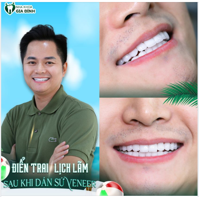LÀM RĂNG PHONG THỦY - TIỀN TÀI LÊN NHƯ DIỀU GẶP GIÓ