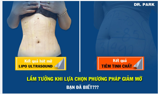 LẦM TƯỞNG KHI LỰA CHỌN PHƯƠNG PHÁP GIẢM MỠ, BẠN ĐÃ BIẾT