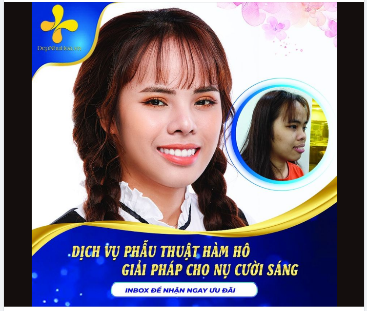 LỘT XÁC ĐỂ CÓ CUỘC ĐỜI TƯƠI ĐẸP