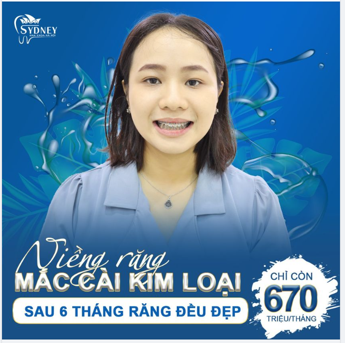 LÝ DO BẠN MUỐN NIỀNG RĂNG NHƯNG CHƯA THỰC HIỆN 