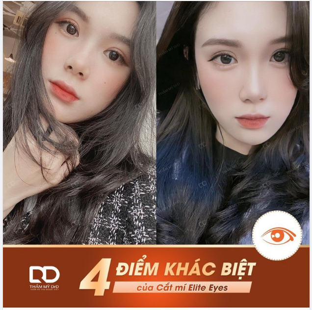 LÝ DO GÌ CẮT MÍ ELITE EYES ĐƯỢC YÊU THÍCH LỰA CHỌN
