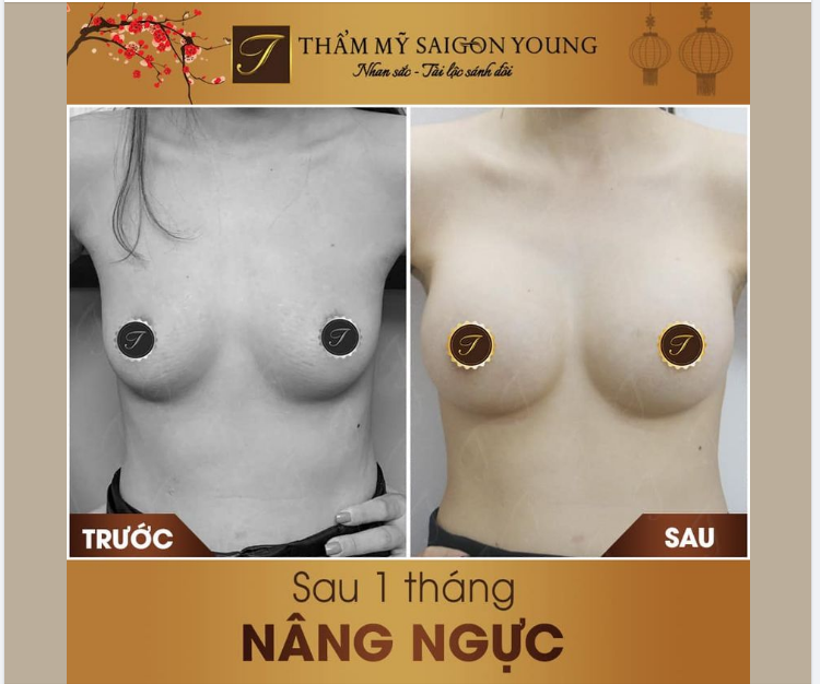 MẠNH DẠN THAY ĐỔI V1 VÀ CÁI KẾT