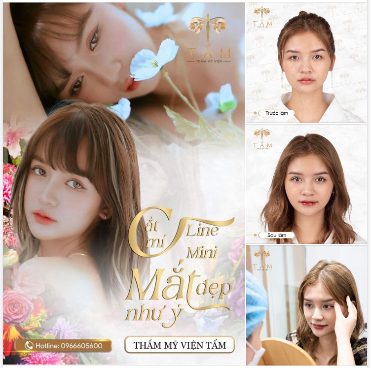 MẮT HAI MÍ ĐÚNG Ý VỚI CẮT MÍ LINE MINI