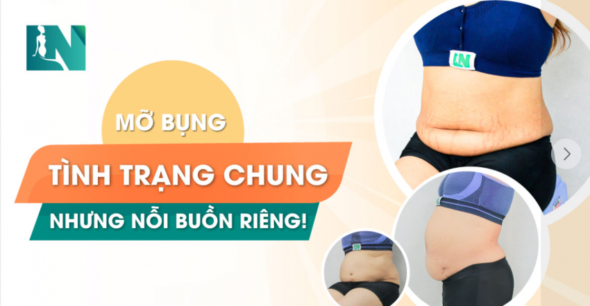 MỠ BỤNG – TÌNH TRẠNG CHUNG NHƯNG  NỖI BUỒN RIÊNG!