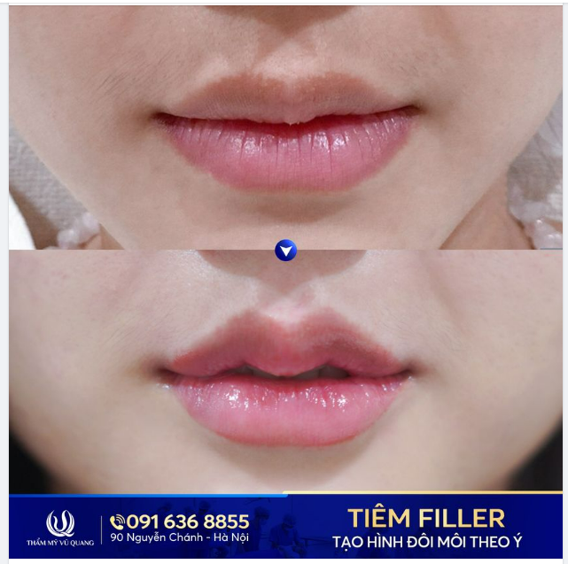 Môi bạn đang gặp phải vấn đề gì