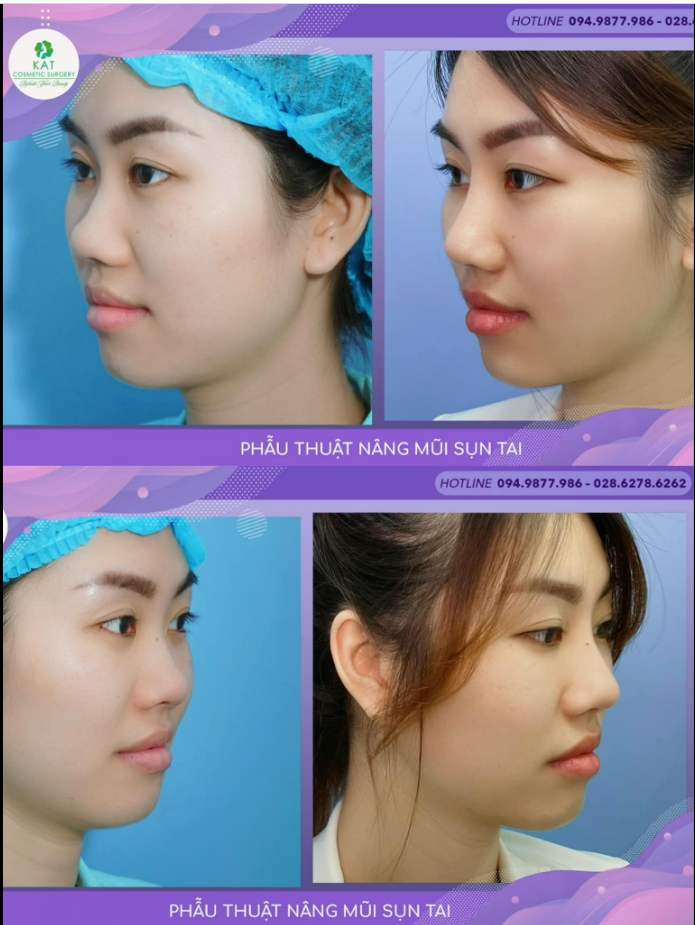 MỘT GÓC NGHIÊNG THẬT KHÁC