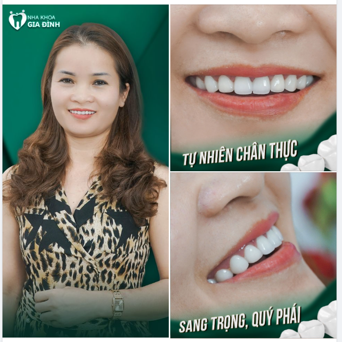 MỘT NỤ CƯỜI CŨNG KHIẾN NGƯỜI PHỤ NỮ TRỞ NÊN SANG TRỌNG, QUÝ PHÁI HƠN