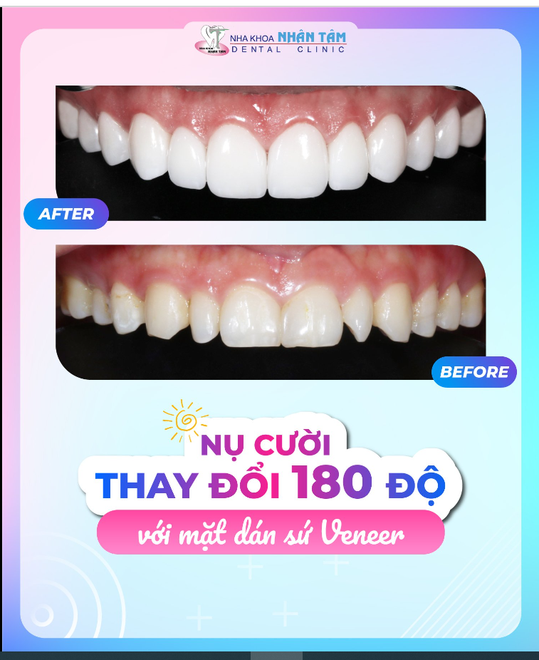 Một nụ cười đẹp sẽ giúp chúng ta tỏa sáng hơn trước đám đông?