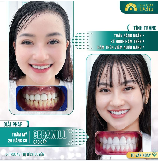 Một nụ cười trọn vẹn, là nụ cười có đủ yếu tố khỏe đẹp