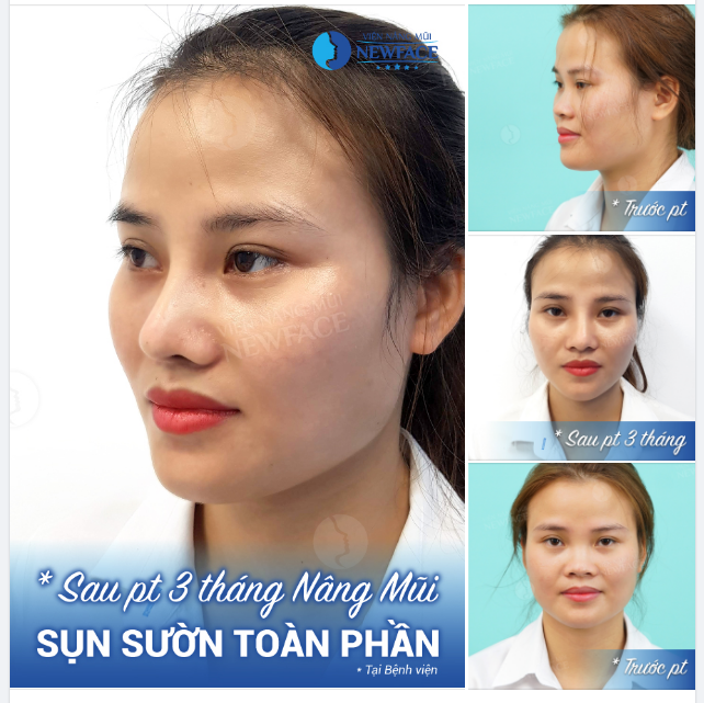 Mùa đông lá sẽ rụng. Gần em sẽ rung động