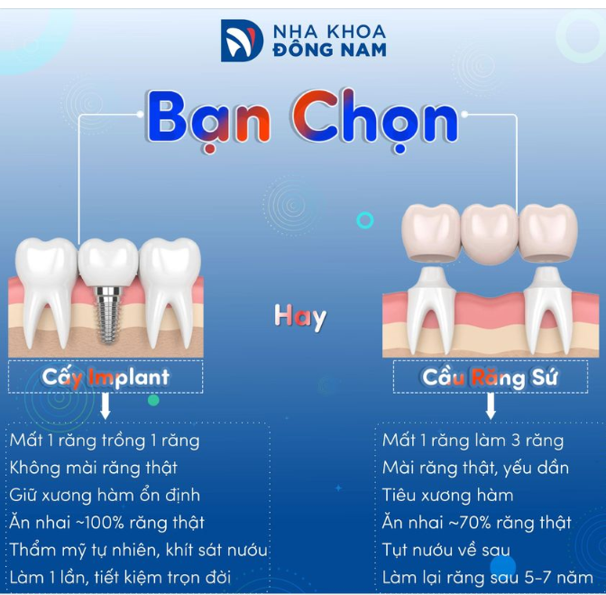 Mục đích chính của trồng răng là phải ăn nhai khỏe, thẩm mỹ bền vững và bảo vệ các răng thật còn lại.