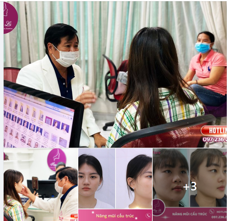 MŨI ĐẸP SANG XỊN CHỈ SAU 02 LẦN GHÉ HIỆP LỢI