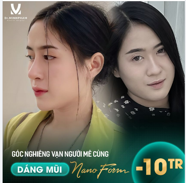 MŨI XINH NHƯ Ý - MẶT ĐẸP HẾT Ý