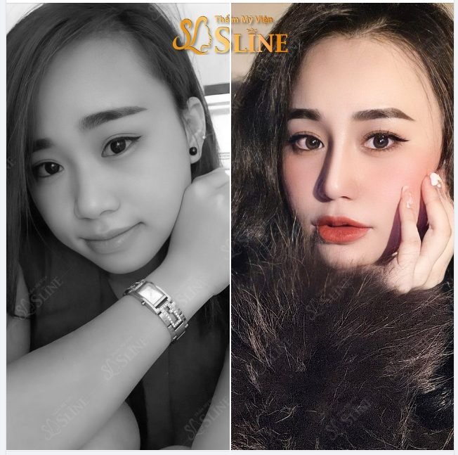 MŨI XINH - RINH QUÀ TẶNG