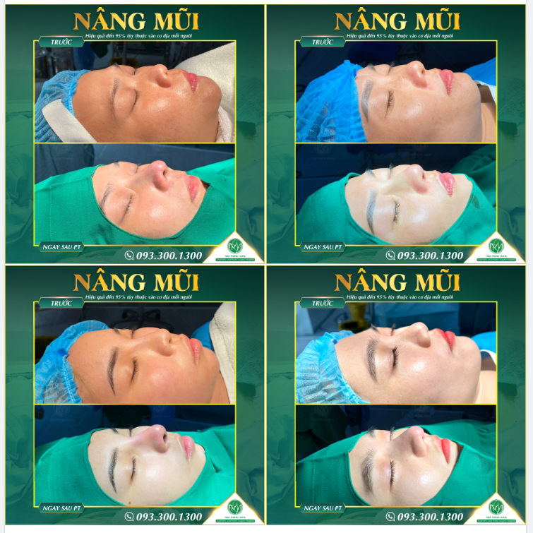 MUỐN ĐẸP LÀ KHÔNG ĐỢI!!!
