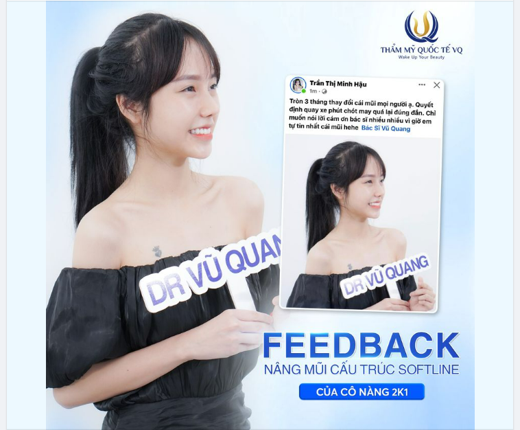 Muốn nâng mũi - Nhất định phải xem Feedback của K.H