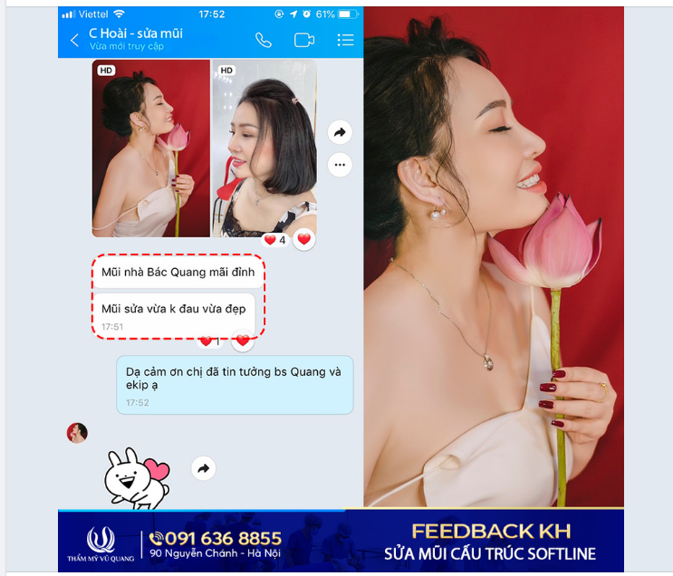 Muốn sửa mũi nhưng sợ đau.... Muốn sửa mũi nhưng sợ lại hỏng