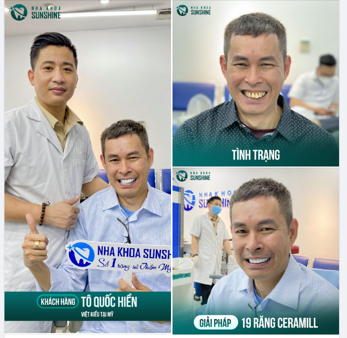 Mỹ là quốc gia rất phát triển - Công nghệ, trang thiết bị tại Mỹ hiện đại - Dịch vụ răng sứ thẩm mỹ rất thịnh hành tại Mỹ.