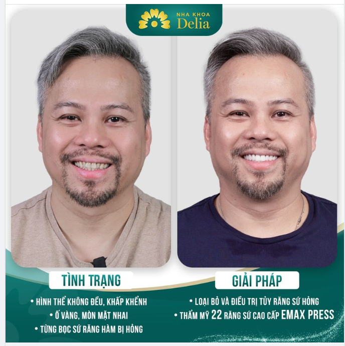 Nâng cấp nụ cười - Phong độ nhân đôi