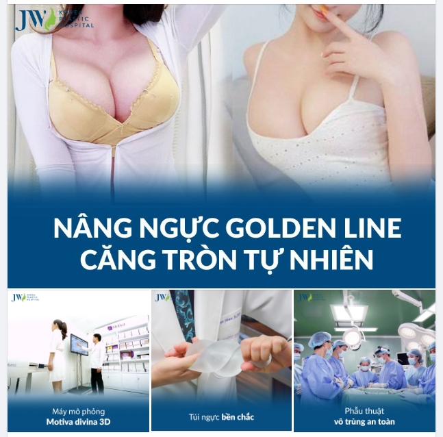 NÂNG CẤP VÒNG 1 GOLDEN LINE - CĂNG TRÒN TỰ NHIÊN, SEXY KHÓ CƯỠNG