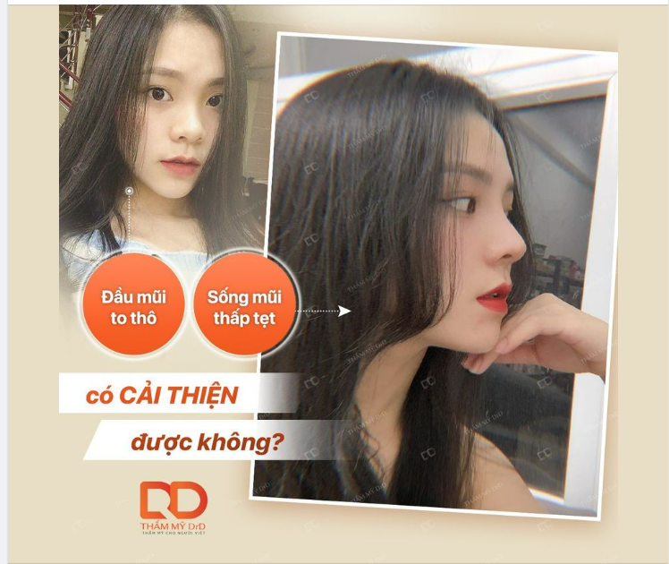 NÀNG ĐẸP XINH - TỰ TIN KHOE GÓC NGHIÊNG THẦN THÁNH
