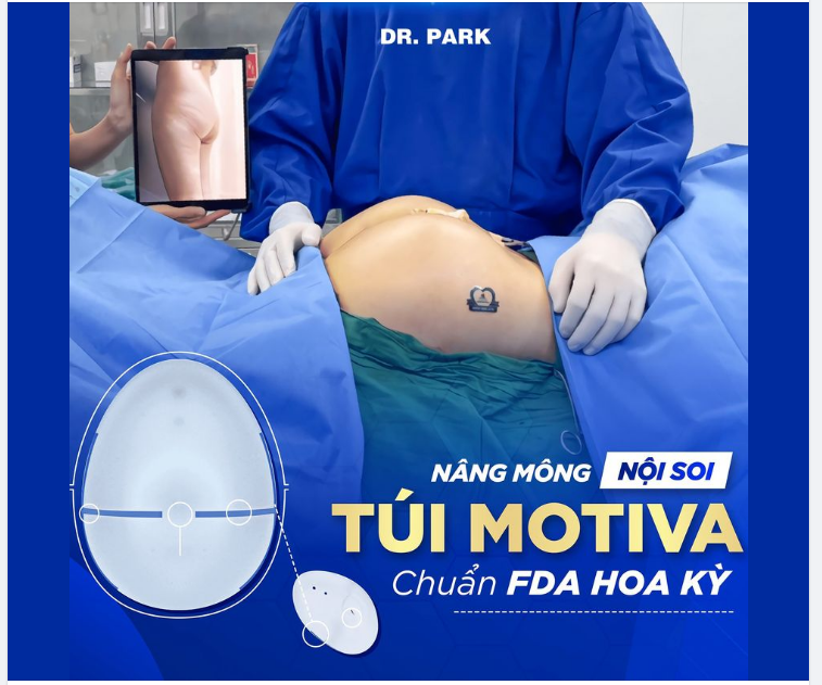 NÂNG MÔNG NỘI SOI TÚI MOTIVA - GIẢI PHÁP CHO VÒNG 3 THÊM QUYẾN RŨ
