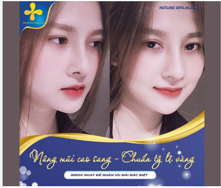 NÂNG MŨI CAO SANG - CHUẨN TỶ LỆ VÀNG
