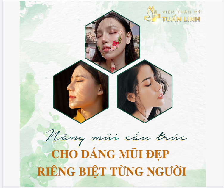 NÂNG MŨI CẤU TRÚC - CHO DÁNG MŨI ĐẸP RIÊNG BIỆT TỪNG NGƯỜI