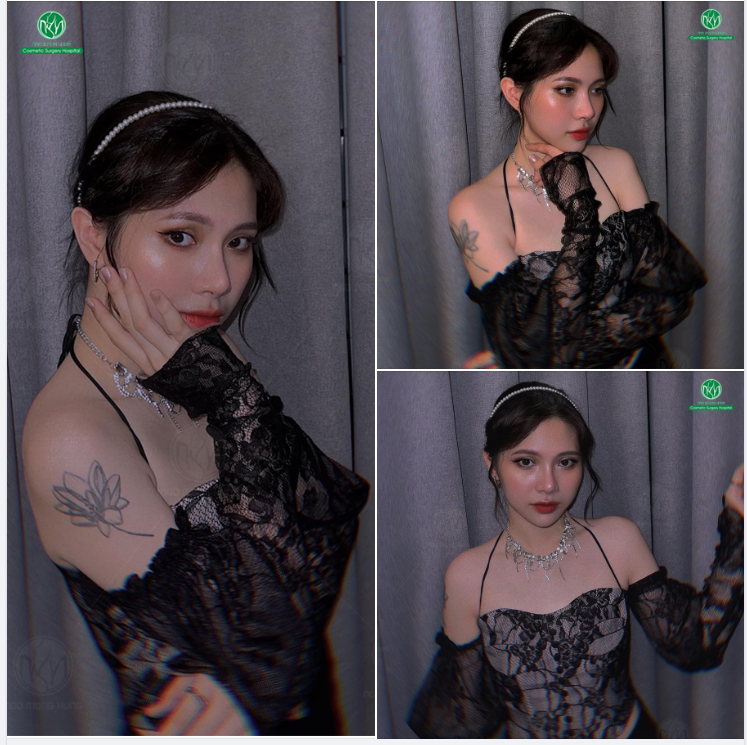 NÂNG MŨI NHẸ NHÀNG VÀ CÁI KẾT !!