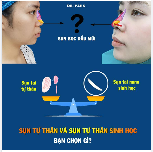 NÂNG MŨI SỢ LẤY SỤN TAI, HÃY CHỌN SỤN TAI NANO SINH HỌC