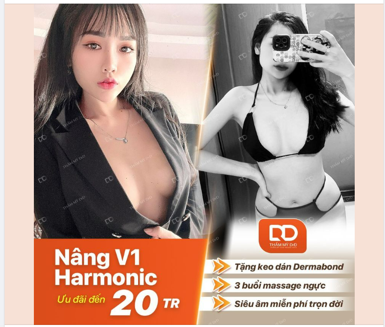 NÂNG V1 HARMONIC TẠI DrD VỚI SIÊU ƯU ĐÃI