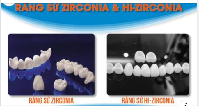 NÊN CHỌN RĂNG TOÀN SỨ ZIRCONIA HAY HI-ZIRCONIA?