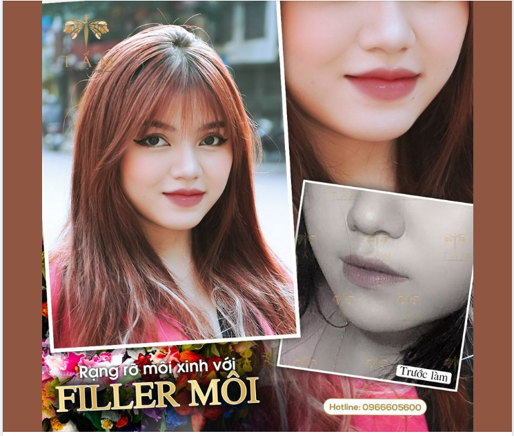 Nếu cặp mắt là cửa sổ tâm hồn thì ĐÔI MÔI lại là định nghĩa về sự cá tính của phái đẹp