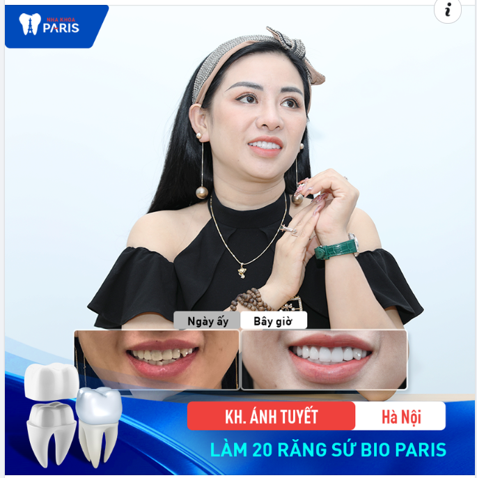 Nếu đôi mắt là cửa sổ tâm hồn, vậy hãy để nha khoa Paris tô điểm hàm răng, nụ cười cho tâm hồn ấy càng tươi tắn, rạng rỡ.